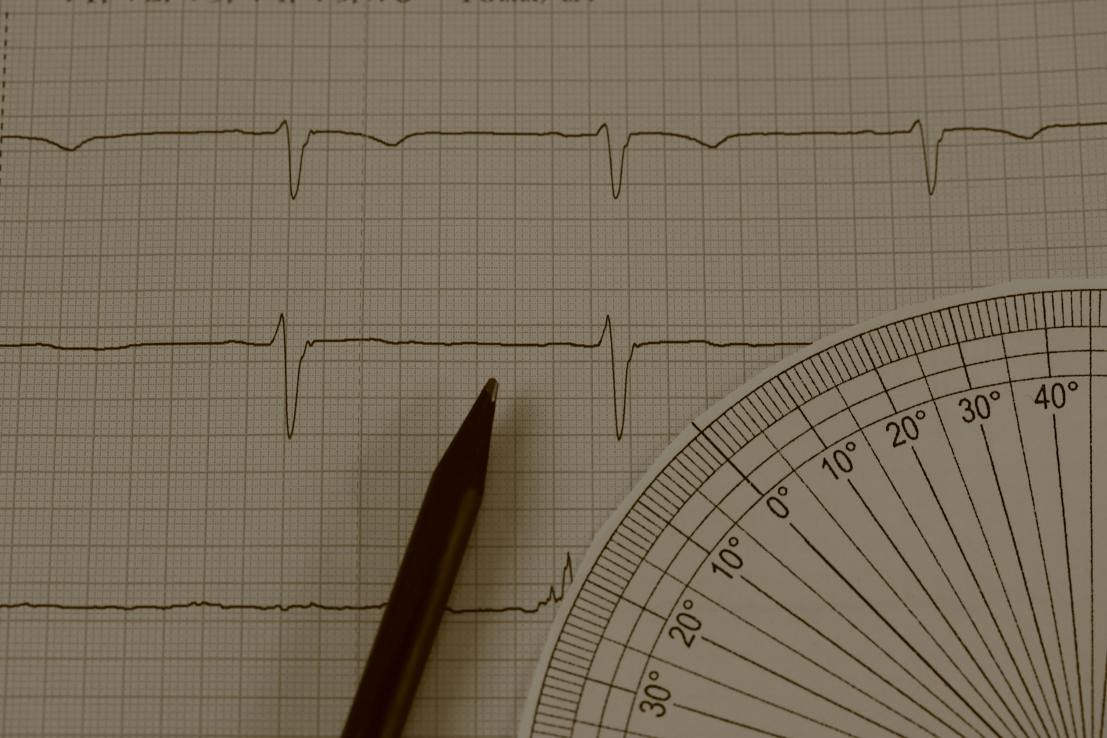 ECG tracing on graph paper with a pencil and protractor